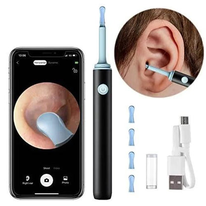 Smart Ear Cleaner with Camera & LED Light – Wireless Ear Wax Removal Kit