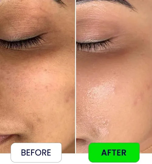 Face & Body Moisturizing Cream 200 Gram Jar(Buy 1 Get 1 Free)